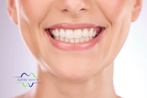 Follow your teeth whitening aftercare Norwich to prolong your whiter smile!